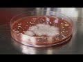 Hand Washing Practices and Effects