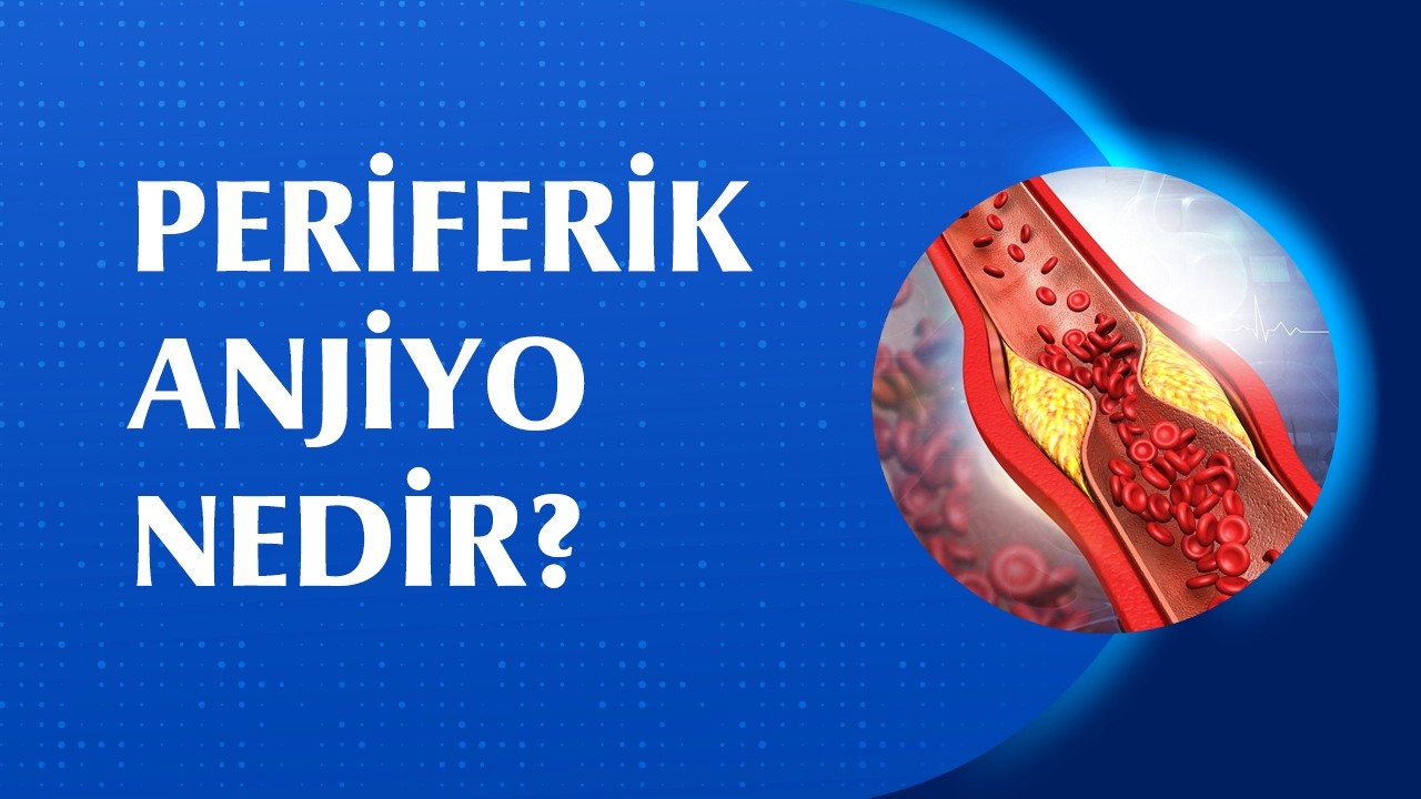 Periferik Anjiyo Nedir? Nasıl Yapılır?