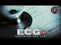 ECG Interpretation and Heart Activity