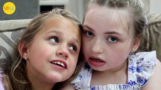 Nonspeaking Best Friends with the Same Rare Syndrome (Rett)