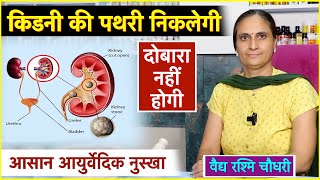 ऐसे निकलेगी गुर्दे की पथरी, दोबारा नहीं होगी, बिल्कुल आसान तरीका #kidneyhealth