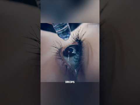 The Eye Drops That Changed Everything 👁️😨