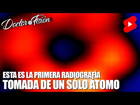 La PRIMERA RADIOGRAFÍA de UN ÁTOMO ?