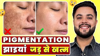 Pigmentation, Dark Spots, झाइयां जड़ से ख़त्म: Best Night Skincare Routine for Clear Skin