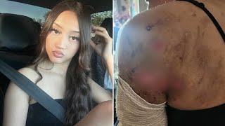 Teen Girl Mauled by 10 Dogs: California Community in Shock