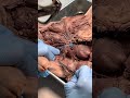 Human Circulatory System Vessels