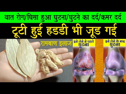 पानी में ये 3 चीजे मिलाकर पीलो 99% घुटनों का दर्द Joint Pain, Arthritis बिलकुल ठीक | knee pain