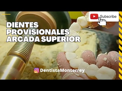 Pulido de DIENTES  Provisionales 👅 en 3 pasos