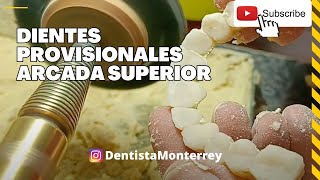 Pulido de DIENTES  Provisionales 👅 en 3 pasos