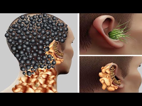 ASMR Ear Animation treatment