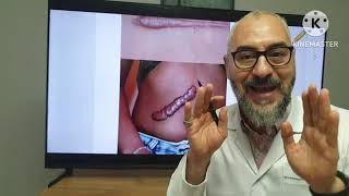 باحث إسلامي وطبيب مشهور يكتشف علاجًا سينقذ مرضى السرطان #علاج_السرطان  #د/عماد_عبد العظيم
