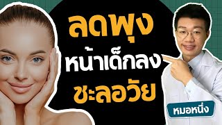 สูตรชะลอวัย เด็กลง 10 ปี พุงหาย หน้าเรียว I หมอหนึ่ง Healthy Hero