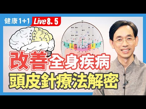 《自然》雜誌「生物全息律」理論，證實了頭皮針功效，頭皮針應用廣泛，可治療很多疾病，分爲四類，中樞神經系統，精神障礙，疼痛與感覺異常，外感與內臟功能失調。| （2023.08.05）健康1+1 · 直播