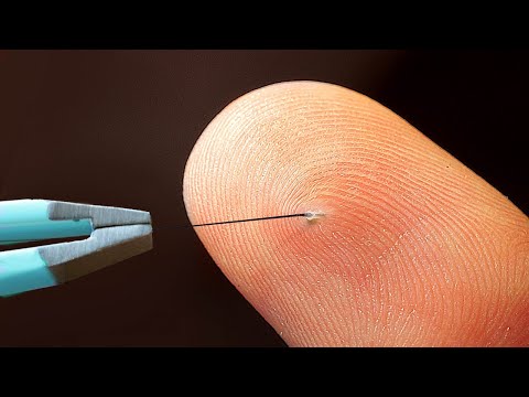 REMOVING A HAIR UNDER A MICROSCOPE