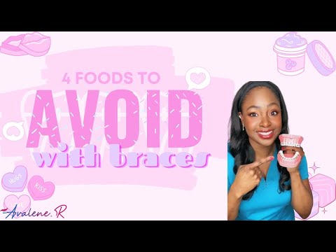 4 foods to AVOID with braces! | This holiday #holidayswithshorts #shortsirl