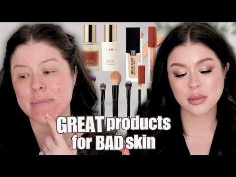 GRWM: AMAZING Makeup Products For Your BAD Skin | How To Hide Imperfections