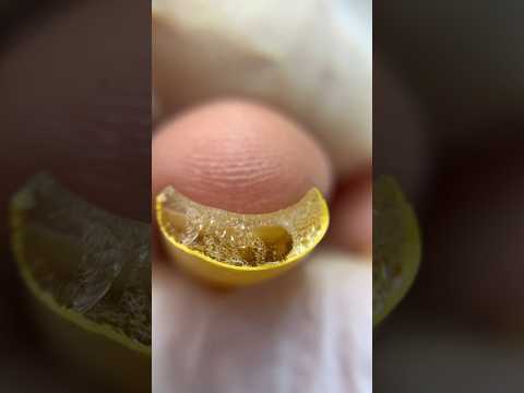 ¿¡Peligrosos HONGOS En Las Uñas!? O… 😳😱🤯