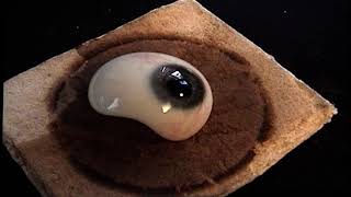 Herstellung Glasauge - künstliches Auge - Augenprothese - Glasauge. Augenprothetik Lauscha GmbH