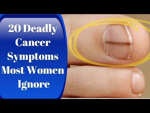 20 Signs Of Cancer Often Ignored By Women!