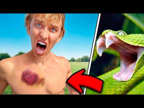 SNAKE ATTACKED ME!! rushed to hospital…