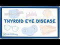 Thyroid Eye Disease Overview