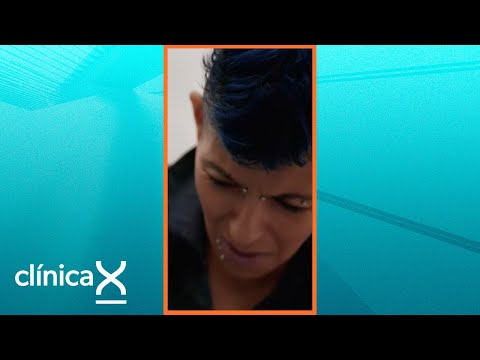 Una araña violinista es la causa del problema | Clínica X