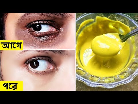 চোখের নিচের কালো দাগ দূর করুন | How To Remove Dark Circles Under Your Eyes Naturally