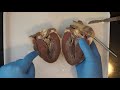 Heart Anatomy and Blood Flow Concepts
