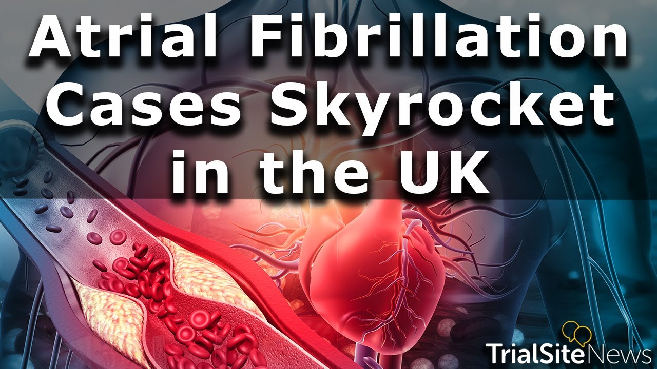 Atrial Fibrillation Cases Skyrocket in the UK — 1 in 45 Now Live with Condition