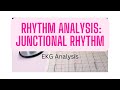 Junctional Rhythms and EKG Interpretation