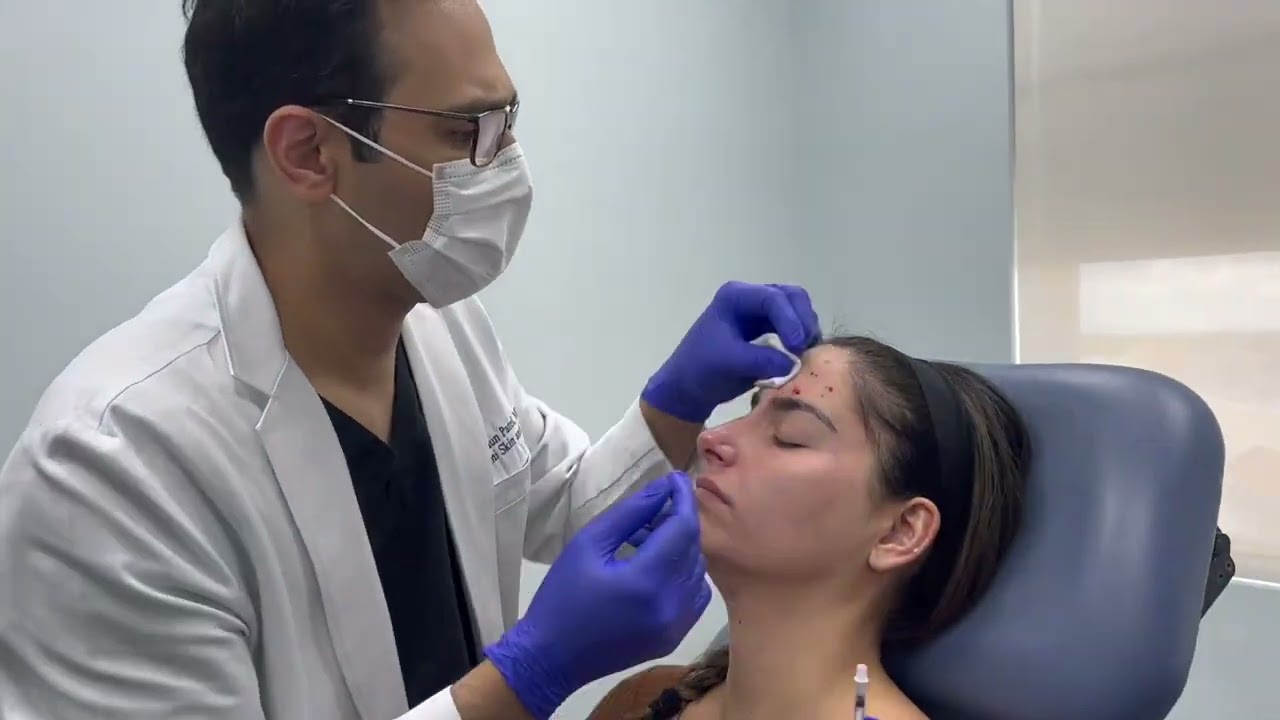 Woman with markings for cosmetic procedure preparation.
