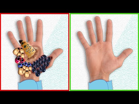 ASMR Remove Maggots & Dog Ticks From Hand | Severely Injured Treatment Animation