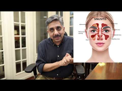 Sinusitis Again ? These 2 Natural Medicines will treat Sinusitis Permanently