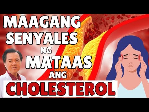 Maagang Senyales ng Mataas ang Cholesterol. - By Doc Willie Ong