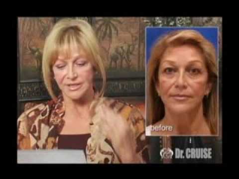 Before and after cosmetic procedure comparison.