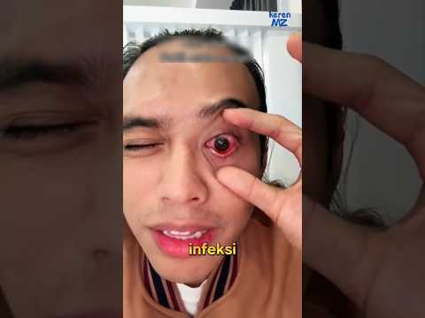 bahaya tidur mata terbuka!!😱😱