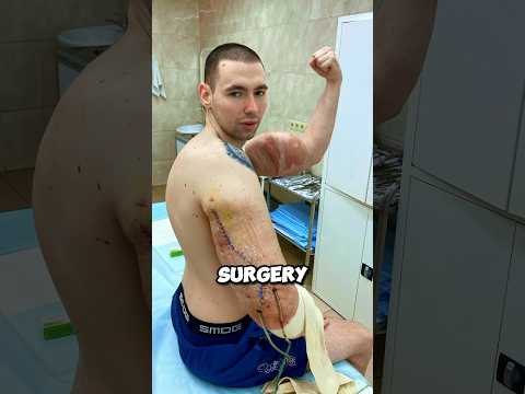 ?Shocking?His Fake Muscles Exploded?#shorts #bodybuilding #fitness