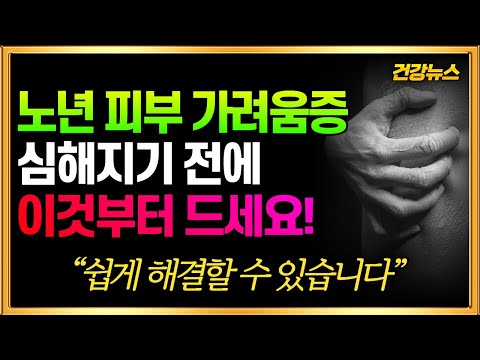 노년 피부 가려움증! 심해지기 전에 이것부터 드세요! 쉽게 해결할 수 있습니다!