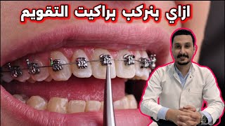 بدأت قناة "Dr.Abdullah sultan" بثًا مباشرًا || تعالوا بينا نركب فصوص التقويم