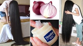 Haftada 2 CM Saç Uzatmak için Vazelin ve Soğan Nasıl Kullanılır? ÇOK HIZLI