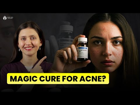 Isotretinoin For Acne | Safety and Results | Complete Information
