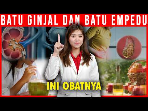 Obat Alami Untuk Batu Ginjal Dan Batu Empedu