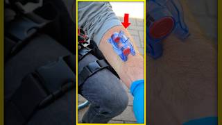 This Clamp Can Stop Bleeding!! 🤯🤯 #new #yt #youtubeshorts #doctor