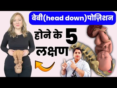 बेबी head down पोज़िशन होने के 5 लक्षण|नॉर्मल डेलिवरी के लिए बेबी अपना सिर नीचे कैसे करता है|