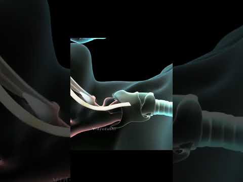 How Ventilator Works