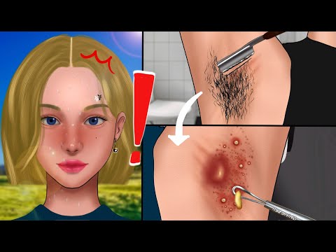 ASMR Satisfying Armpit Hair Removal Animation‼️, Acne, Ingrown Hair