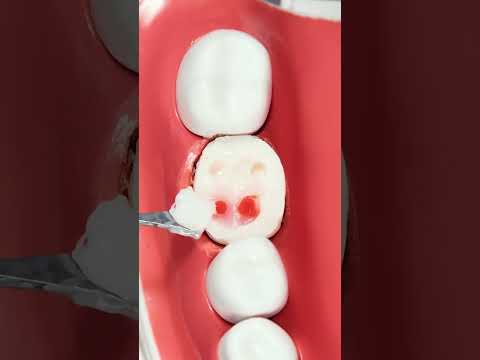 Shocking Behind-the-Scenes of Expensive Medical Procedures!