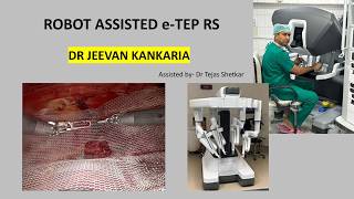 Robot Assisted e-TEP RS | Dr Jeevan Kankaria