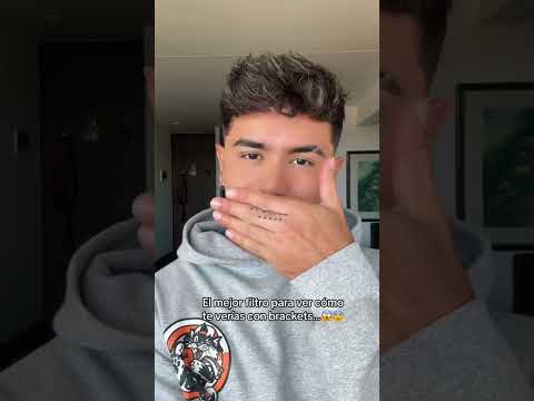 El mejor filtro para ver cómo te verías con bracketS 😱😂