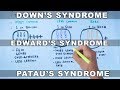Trisomy Disorders and Chromosome 21